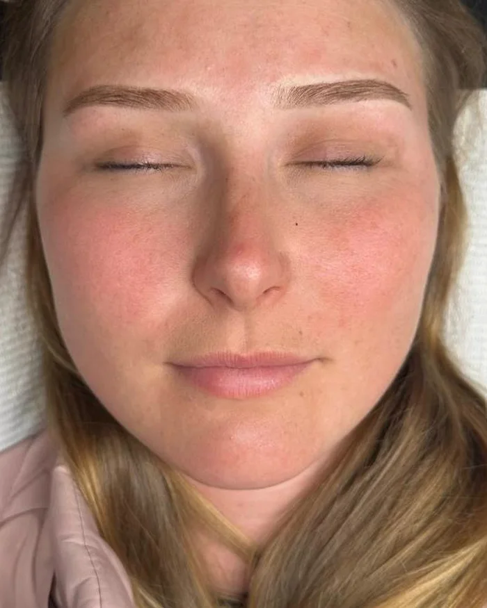Brows after natural brow tattooing
