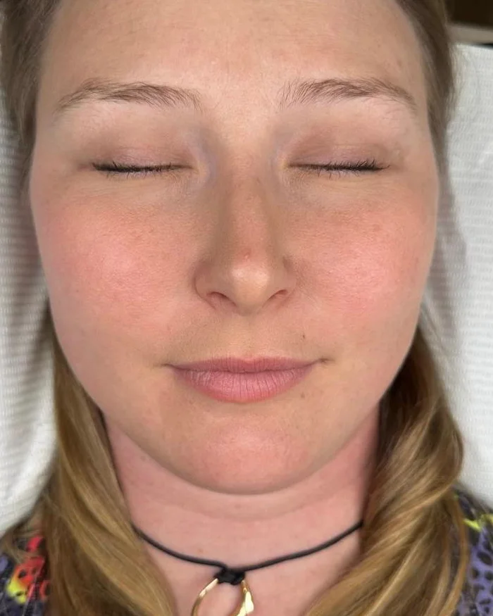 Brows before natural brow tattooing