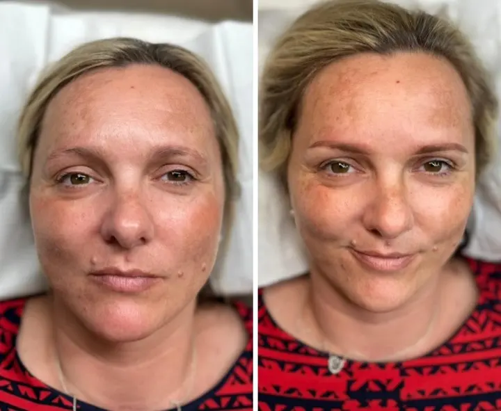 Natural brow tattooing — before and after