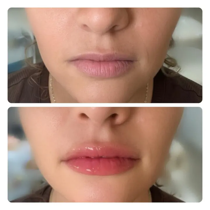 Lip blush — before and after