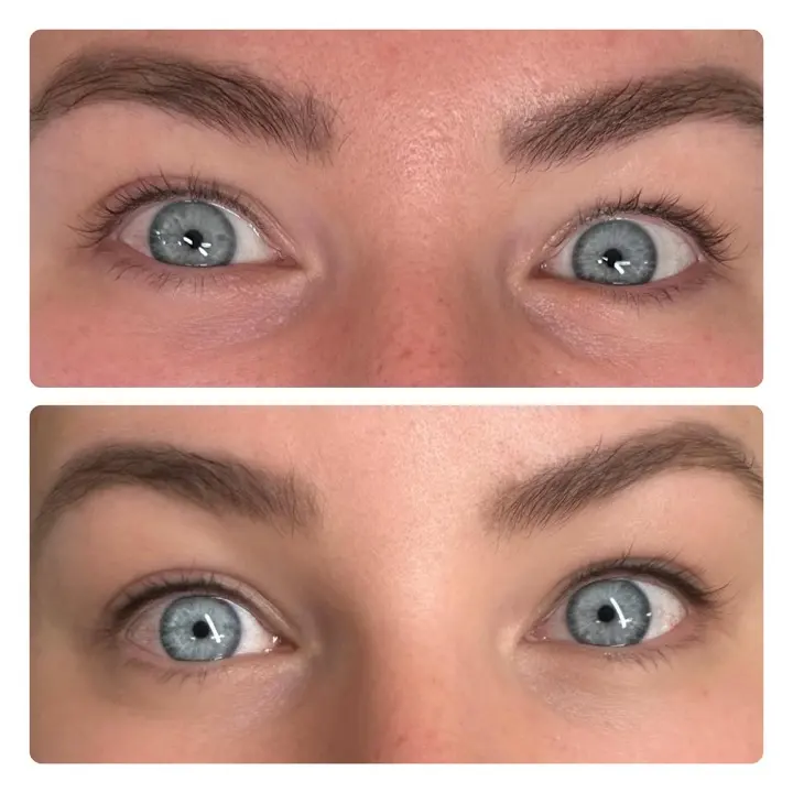 Lash line enhancement — before and after