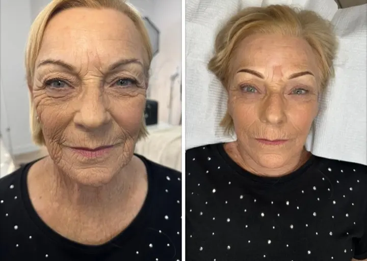 Natural brow tattooing — before and after