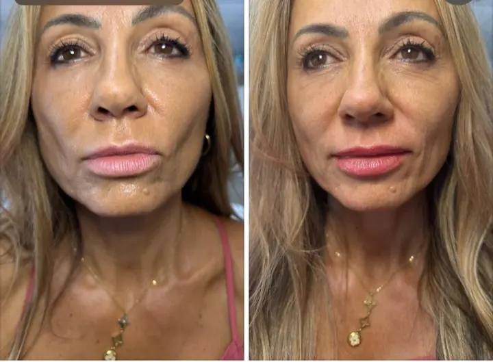 Natural brow tattooing — before and after