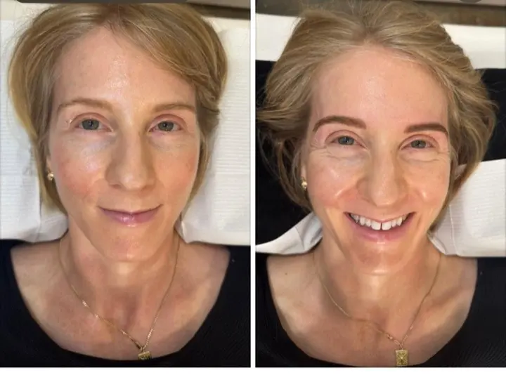 Natural brow tattooing — before and after