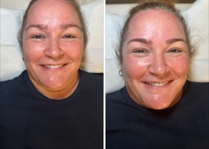 Natural brow tattooing — before and after