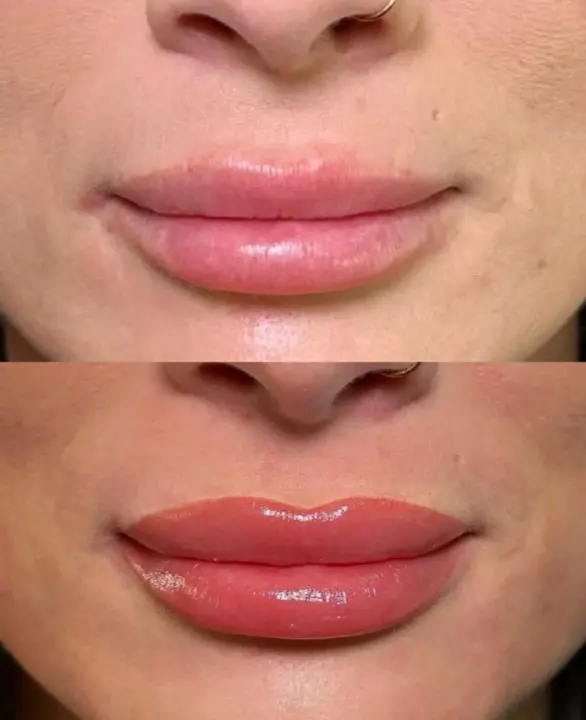 Lip blush — before and after