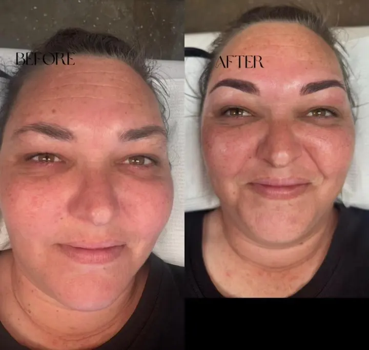 Natural brow tattooing — before and after